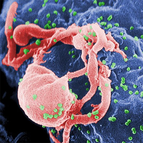 медицина, вирус, ВИЧ, Новая вакцина против ВИЧ на грани открытия