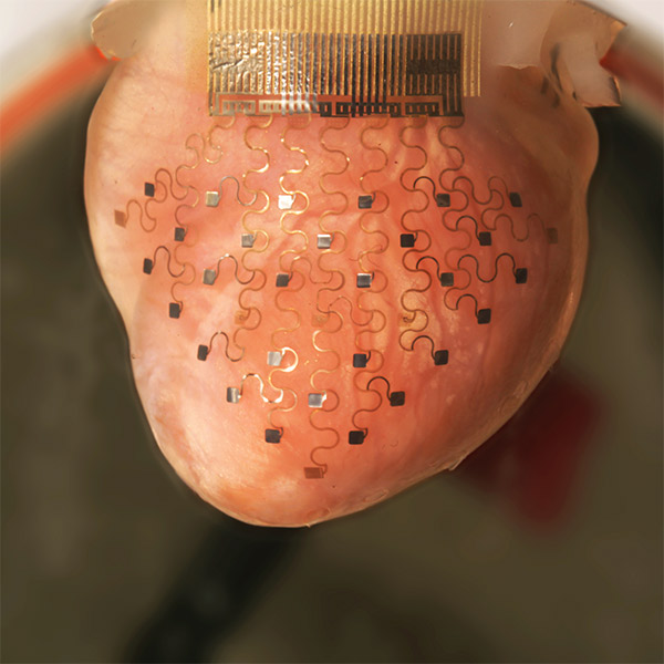 3D-принтер, медицина, сердце, Разработана специальная мембрана, благодаря которой сердце может биться вечно