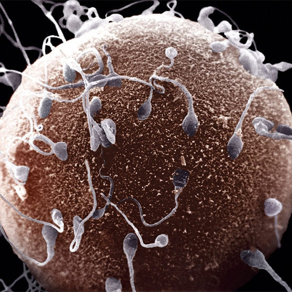 Сперматозоид, медицина, фертильность, Ученые учатся превращать кожу в сперматозоиды